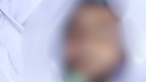 AI Healthcare