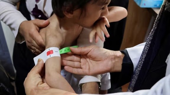 AI Healthcare